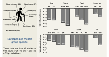 การออกกำลังกายในผู้ใหญ่ และผู้สูงวัย มีความสำคัญกับภาวะ SARCOPENIA