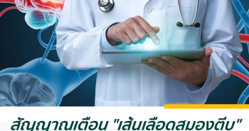 สัญญาณเตือน "เส้นเลือดสมองตีบ" ปัจจัยใดบ้างทำให้เกิดโรค