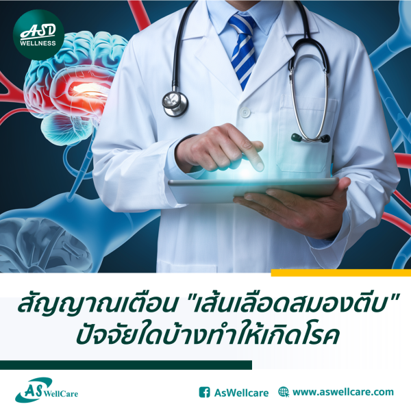 สัญญาณเตือน "เส้นเลือดสมองตีบ" ปัจจัยใดบ้างทำให้เกิดโรค