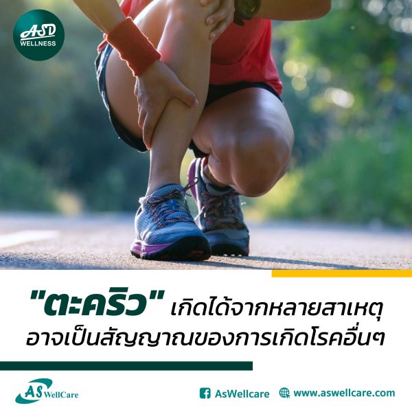 "ตะคริว" เกิดได้จากหลายสาเหตุ อาจเป็นสัญญาณของการเกิดโรคอื่นๆ
