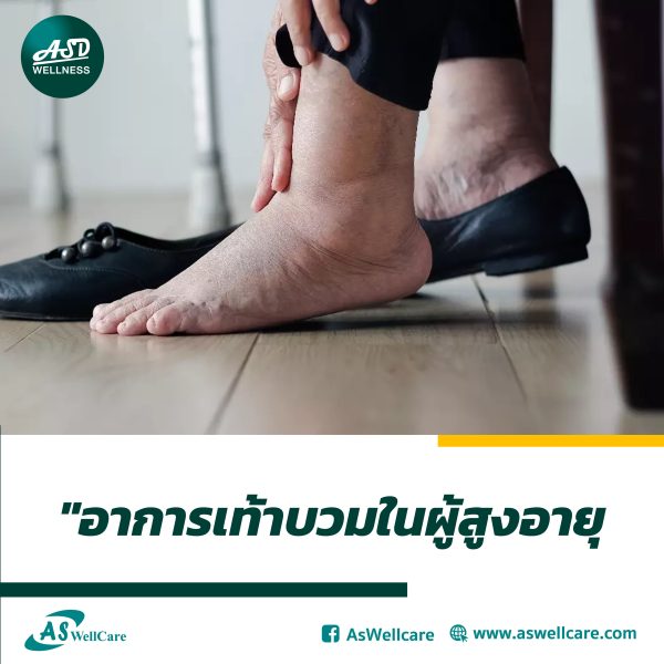 อาการเท้าบวมในผู้สูงอายุ