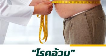 "โรคอ้วน" ภาวะอันตรายทำให้เกิดโรค NCDs