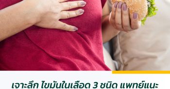 เจาะลึก ไขมันในเลือด 3 ชนิด แพทย์แนะวิธีลดไขมันสูง ภัยเงียบสุขภาพ