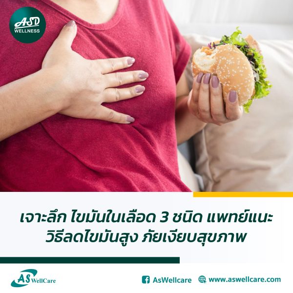 เจาะลึก ไขมันในเลือด 3 ชนิด แพทย์แนะวิธีลดไขมันสูง ภัยเงียบสุขภาพ