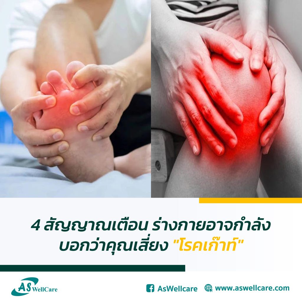 4 สัญญาณเตือน ร่างกายอาจกำลังบอกว่าคุณเสี่ยง "โรคเก๊าท์"