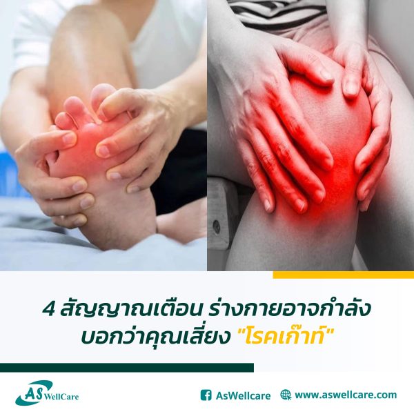 4 สัญญาณเตือน ร่างกายอาจกำลังบอกว่าคุณเสี่ยง "โรคเก๊าท์"