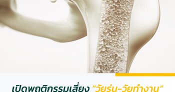 เปิดพฤติกรรมเสี่ยง ‘วัยรุ่น-วัยทำงาน’ ที่อาจทำให้กระดูกพรุนได้