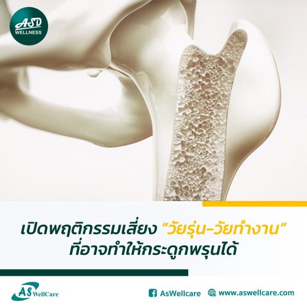 เปิดพฤติกรรมเสี่ยง ‘วัยรุ่น-วัยทำงาน’ ที่อาจทำให้กระดูกพรุนได้