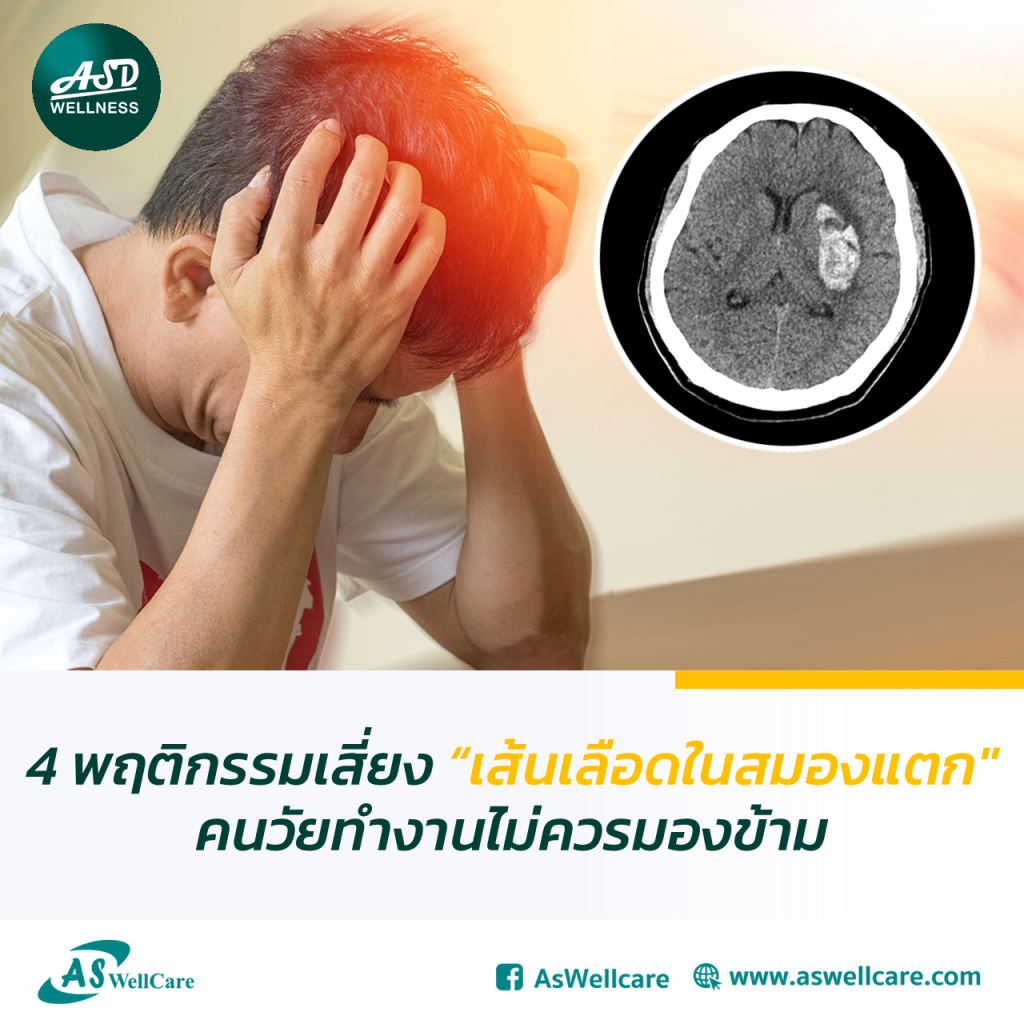 4 พฤติกรรมเสี่ยง “เส้นเลือดในสมองแตก” คนวัยทำงานไม่ควรมองข้าม