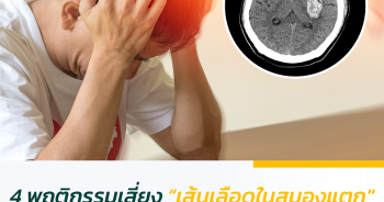 4 พฤติกรรมเสี่ยง “เส้นเลือดในสมองแตก” คนวัยทำงานไม่ควรมองข้าม