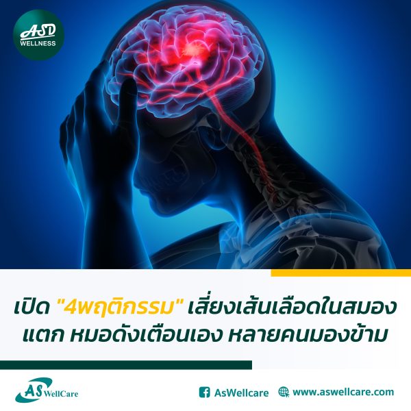 เปิด "4พฤติกรรม" เสี่ยงเส้นเลือดในสมองแตก หมอดังเตือนเอง หลายคนมองข้าม