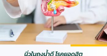 นิ่วในถุงน้ำดี โรคยอดฮิตที่สายบุฟเฟต์ทั้งหลายต้องระวังไว้ให้ดี