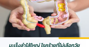 มะเร็งลำไส้ใหญ่ โรคร้ายที่ไม่เลือกวัย เช็กให้ชัวร์ก่อนสายเกินไป